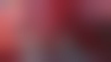 left S3 Segmentectomy with unipotal VATS