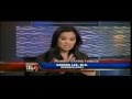 Tinea Versicolor - Dr. Sandra Lee treats White Spots on Fox Studio 11 LA