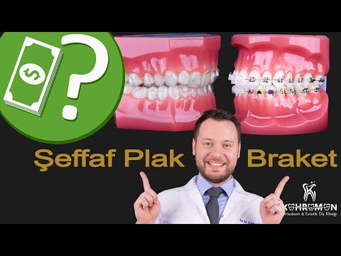 Video: Braket yapımı nedir?