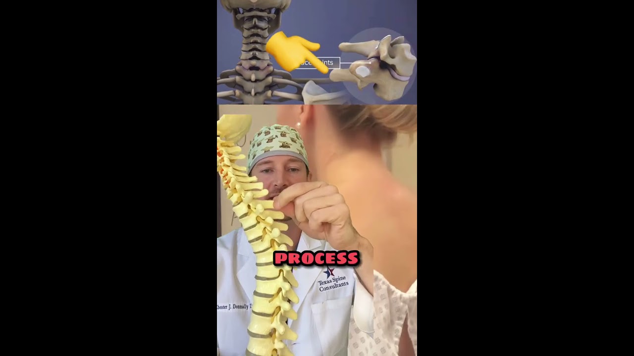 What Is The Bump On Back Of Your Neck Spine Expert Explains 