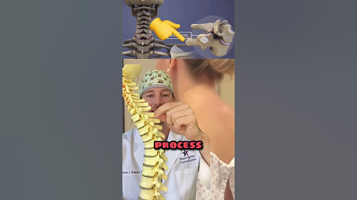 What is the bump on the back of your neck?! (Spine expert explains) 🤯