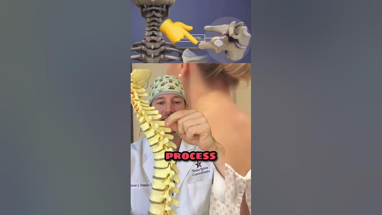 what-is-the-bump-on-the-back-of-your-neck-spine-expert-explains