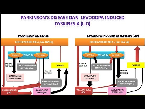 Video 52 Parkinson&rsquo;s Disease dan Levodopa Induced Dyskinesia (LID)