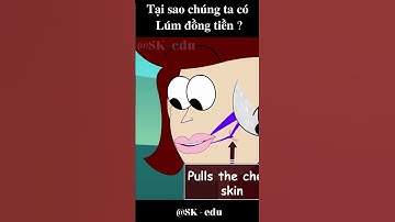 Tại sao một số người có Lúm đồng tiền ? #shorts