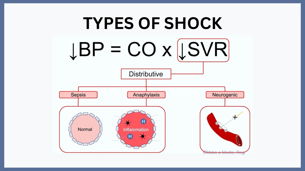 Shock Explained Types of Shock Explained - YouTube