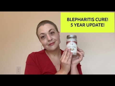 My Blepharitis CURE - 5 years later! Natural Cure for Itchy/Dry Eyelids