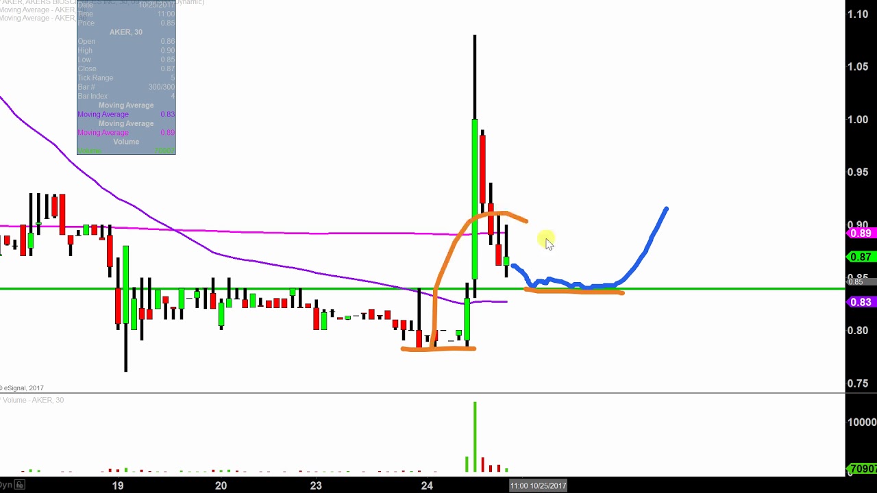 Akers Biosciences Inc - AKER Stock Chart Technical Analysis for 10-24-17