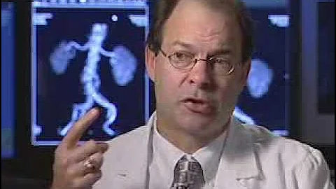 Carotid Stent Procedure Live Panel Discussion