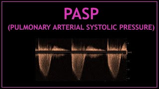 PASP (pulmonary artery systolic pressure)