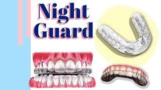 Night Guard :: Types of the night guard / Mouth Splint screenshot 1