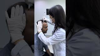 Hair Transplant in Turkey: The new hairline process #hairtransplant #hairlinerestoration