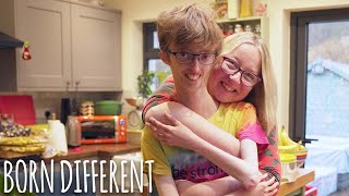 Only 16 People Have My Rare Condition | BORN DIFFERENT