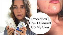 Probiotics  |  How I Cleared Up My Acne  |  Holistic Nutritionist Tips