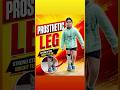 Below Knee Prosthetic Leg | Natural Walking & Comfortable Mobility #naklitang #artificialleg