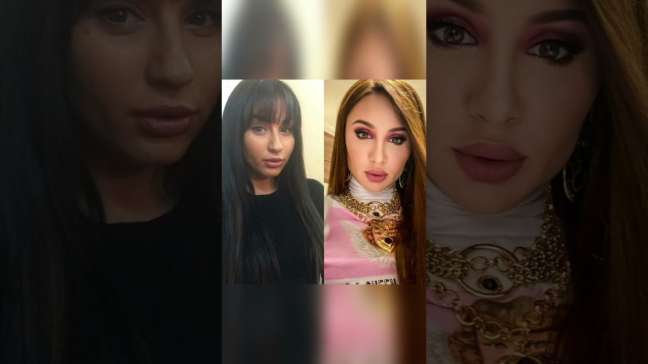 БЕЗ СЛЁЗ НЕ ВЗГЛЯНЕШЬ! Как выглядела певица Анна Асти (ANNA ASTI) до пластики? #Shorts