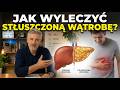 Jak Wyleczyć STŁUSZCZONĄ WĄTROBĘ?