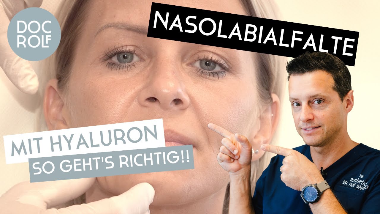 Hyaluron Filler - JUVEDERM ist NICHT gleich Juvederm - es gibt verschiedene \