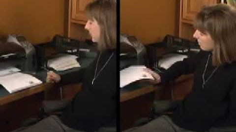 Subject with cervical level spinal cord injury demonstrating hand function with neuroprosthesis