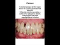 Harmony health with Ankita #gumdisease #oralcare #dentistry #shortvideo #teeth #periodontitis