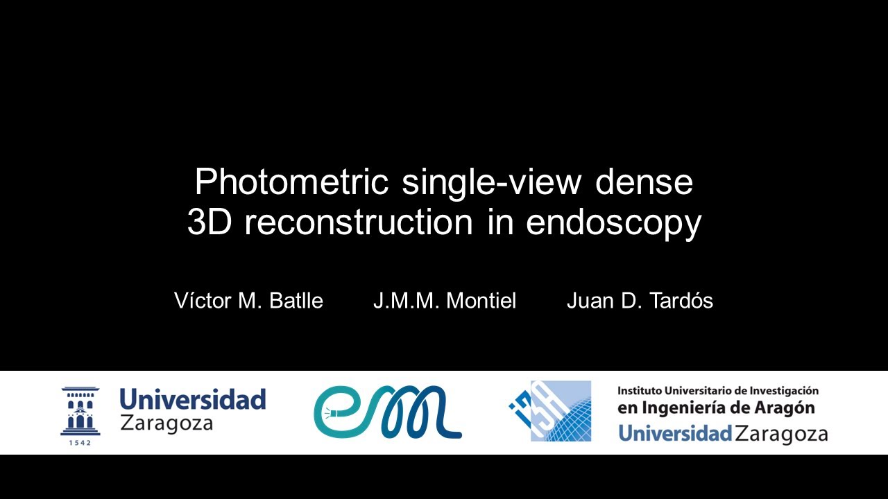 Photometric single-view dense 3D reconstruction in endoscopy