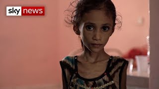 Special report: Yemen's children are starving