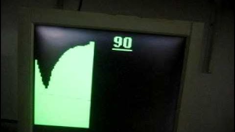 Read ADC  VGA display  Draw chart dsPIC