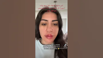 توثيق مراحل فيلر الشفاه قبل وبعد وبعد اسبوع 