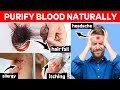 Natural remedies to Keep the Blood Purified | Home remedies to detoxify your blood |