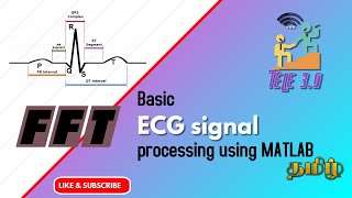 Basic ECG signal Processing using MATLAB