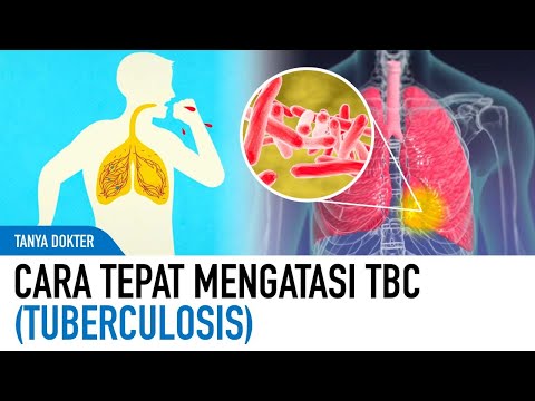 Video: Cara Membuat Ujian Kulit TB dengan betul (dengan Gambar)