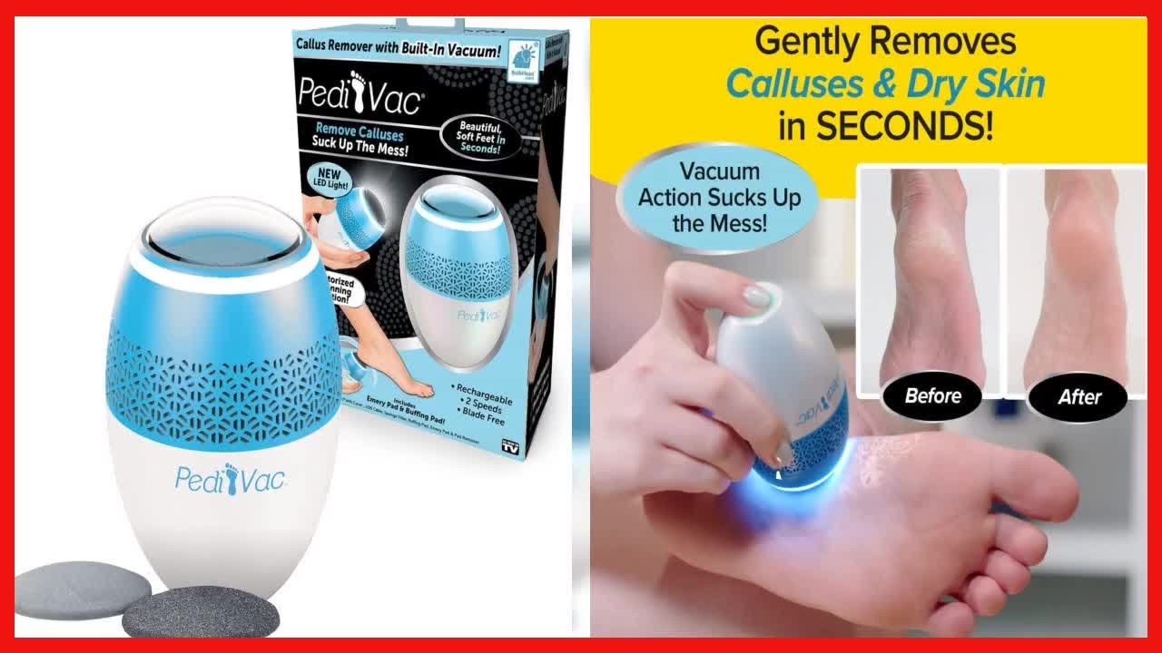 Pedi Vac by Ped Egg - Callus Remover for Feet with Built-in Vacuum Removes  Dead Skin from Feet with 2000 RPMs - Electric Callus Remover Sucks Up