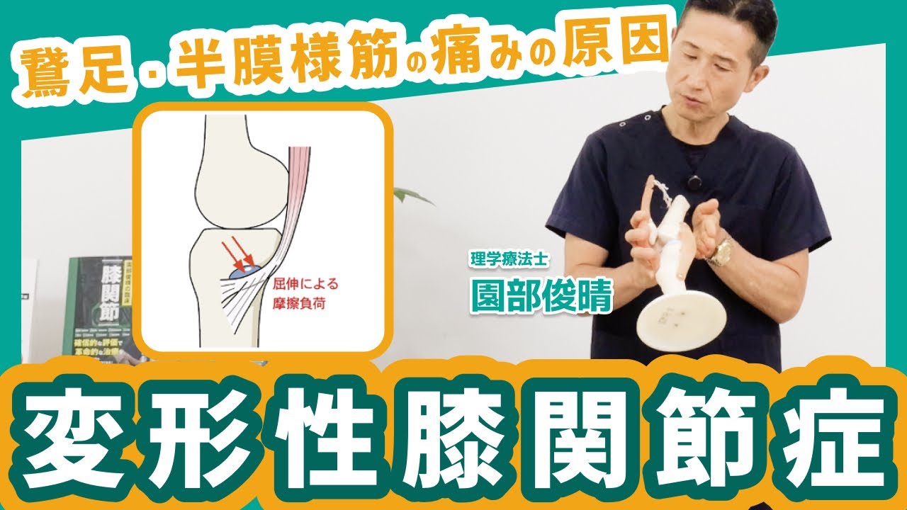 膝OAでなぜ、鵞足や半膜様筋に痛みがでるのか？ - 理学療法士