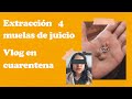 EXTRACCIÓN MUELAS DEL JUICIO || VLOG EN CUARENTENA