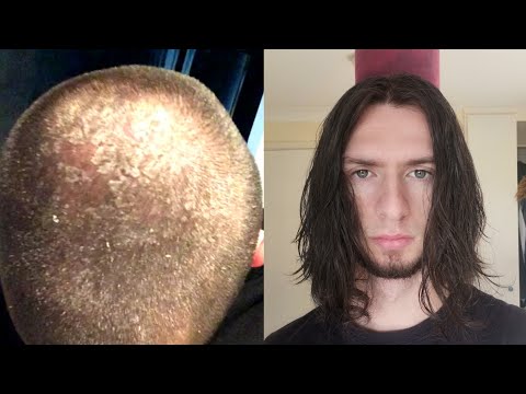 7 years no shampoo results
