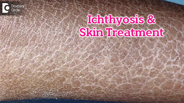 What is Ichthyosis? How to Treat my Skin?| Fish like scales On Skin-Dr.Rasya Dixit | Doctors' Circle