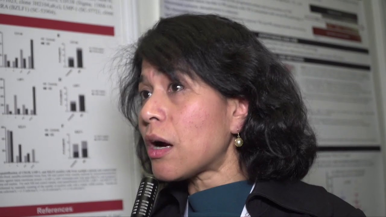 Epstein Barr Virus (EBV) and Multiple Sclerosis