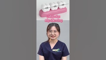 Khớp cắn hở niềng răng rồi mới bọc sứ được nhé #nhakhoathuyanh #shorts #niengrang #bocsu