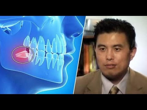Video: Grow New Teeth In 9 Weeks: A Procedure That Is Possible At Any Age! - Alternative View