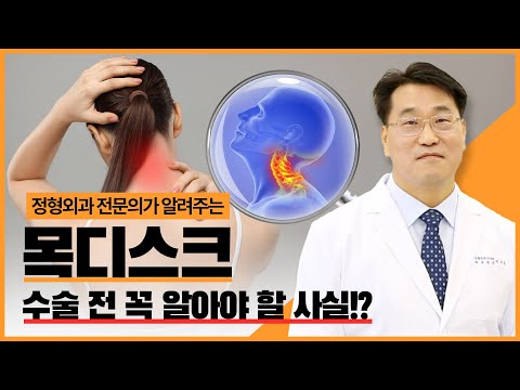 목디스크💥 정형외과 전문의가 속 시원하게 알려드립니다📢목디스크 A to Z🔍