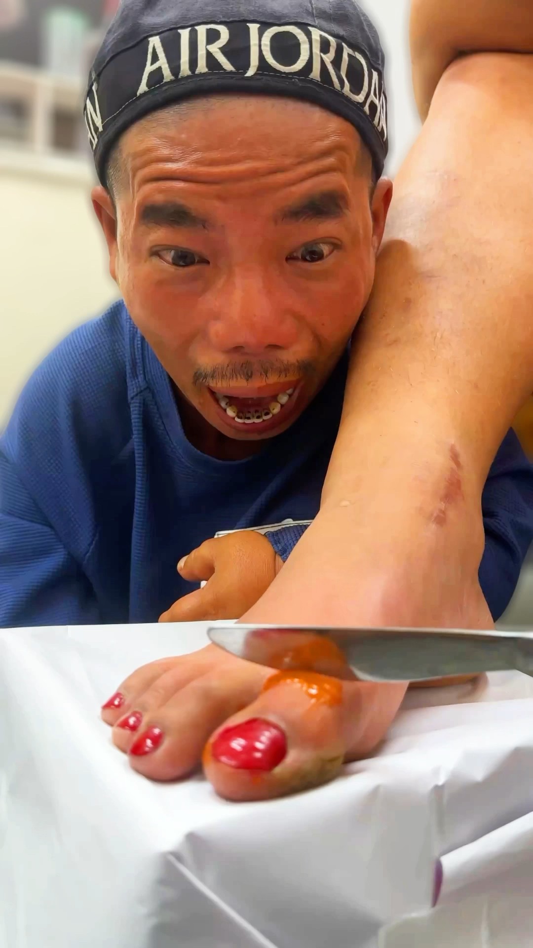 ToRung comedy: magic toes?