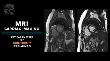 MRI – CARDIAC IMAGING : KEY PARAMETERS OF CINE TRUEFISP EXPLAINED
