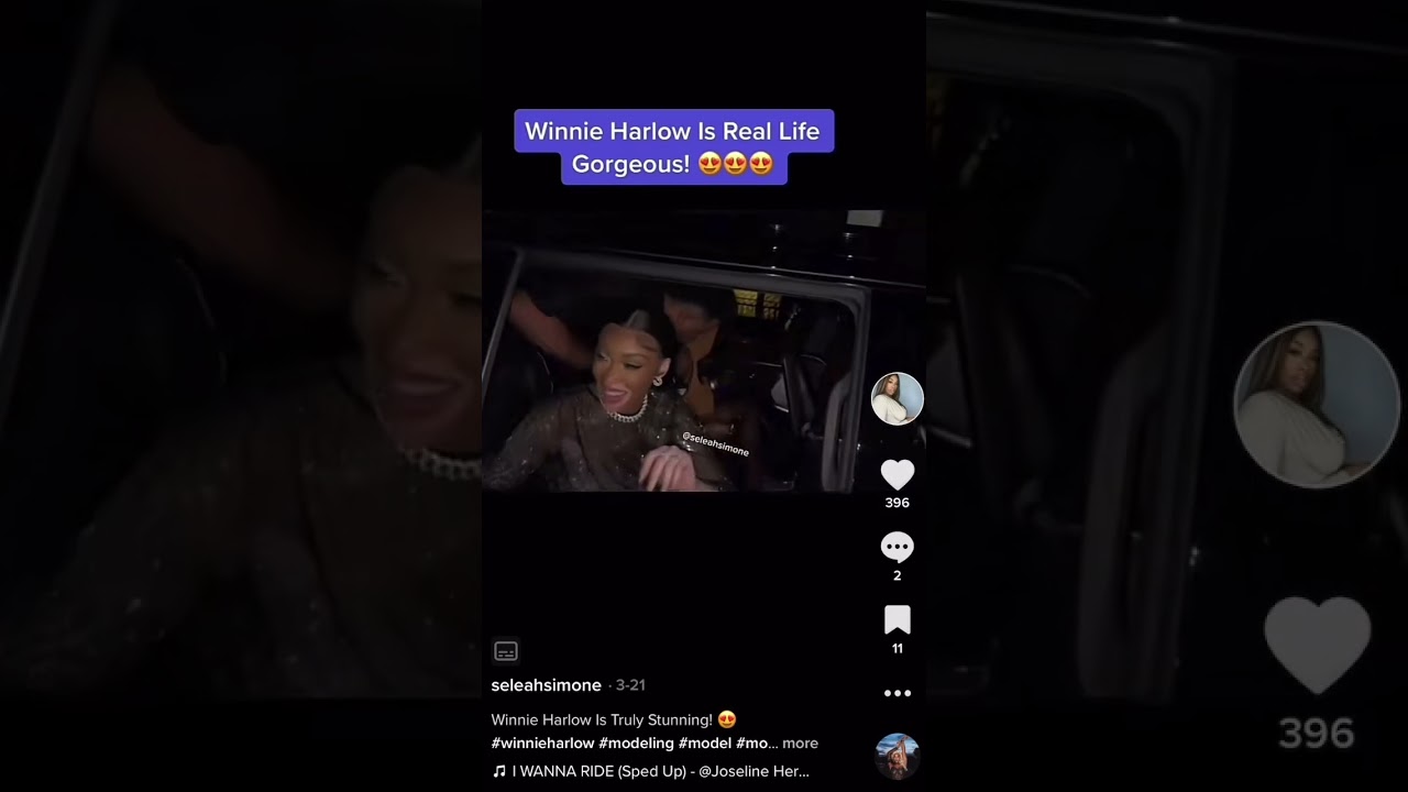 Winnie Harlow Is Real Life Gorgeous 😍