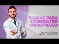 5 Dicas Melhorar Unhas Fracas - Dr Lucas Fustinoni Médico - CRMPR: 30155