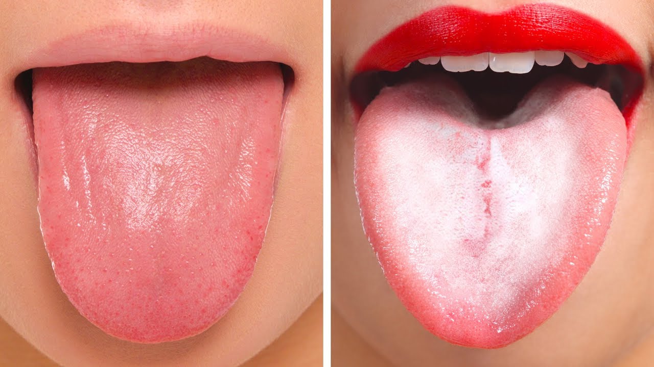 what does a healthy tongue look like