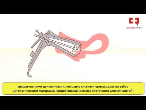 Пап-тест.  Cкрининговая диагностика дисплазии шейки матки и предрака