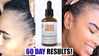 EASY TIP How to Grow Back Your EDGES & NATURAL HAIR in 2 Months!