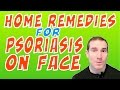 Home Remedies For Psoriasis On Face -