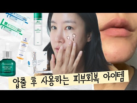 피부 압출 후 관리하는 💉 피부회복 아이템