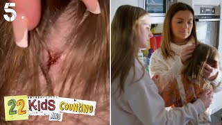 Heidie Had An Accident 😲 | 22 Kids And Counting