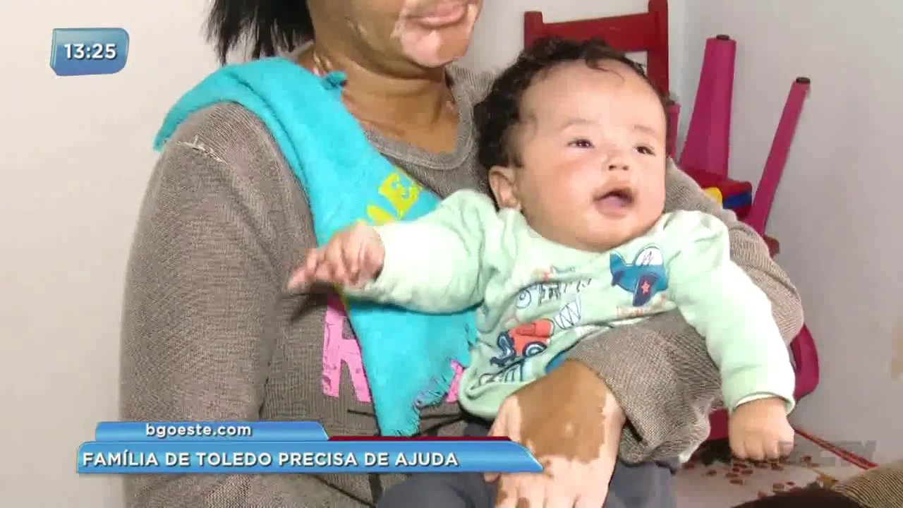 Criança que sofre com convulsões precisa de cirurgia